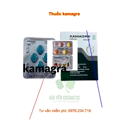 Acheter kamagra en france pas cher